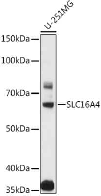 Western Blot: SLC16A4 AntibodyBSA Free [NBP2-94896]